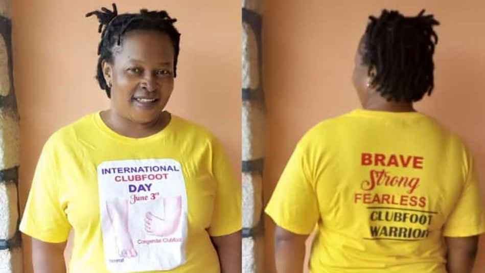 Female portrait photo grid showing front and back, she is wearing a yellow T-shirt written in front "International Clubfoot Day, June 3rd" and on the back of the T-shirt "Brave, strong, fearless, clubfoot warrior"